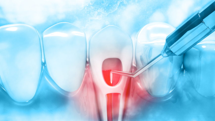 Endodontic Treatments in Turkey – Istanbul skyline during recovery and dental tourism
