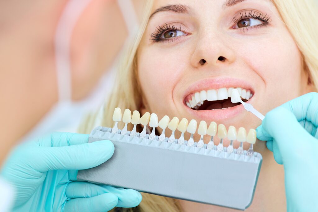 Professional Teeth Whitening for a Brighter Smile