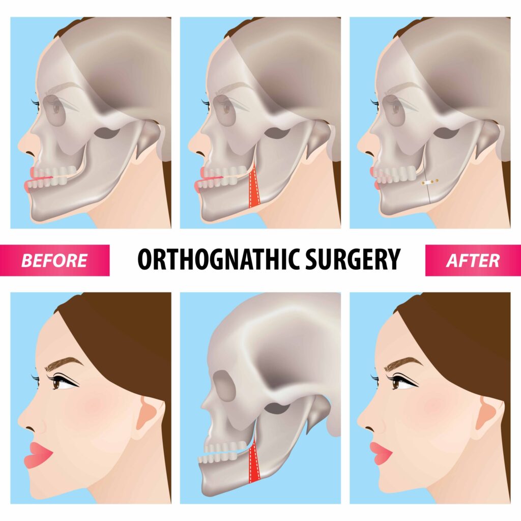 Bariatric Surgery Recovery Timeline Cost Aftercare Questions for International Patients