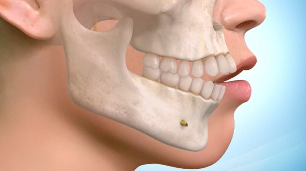 Bariatric Surgery Consultation Guide: Appointment Timeline and Patient Support