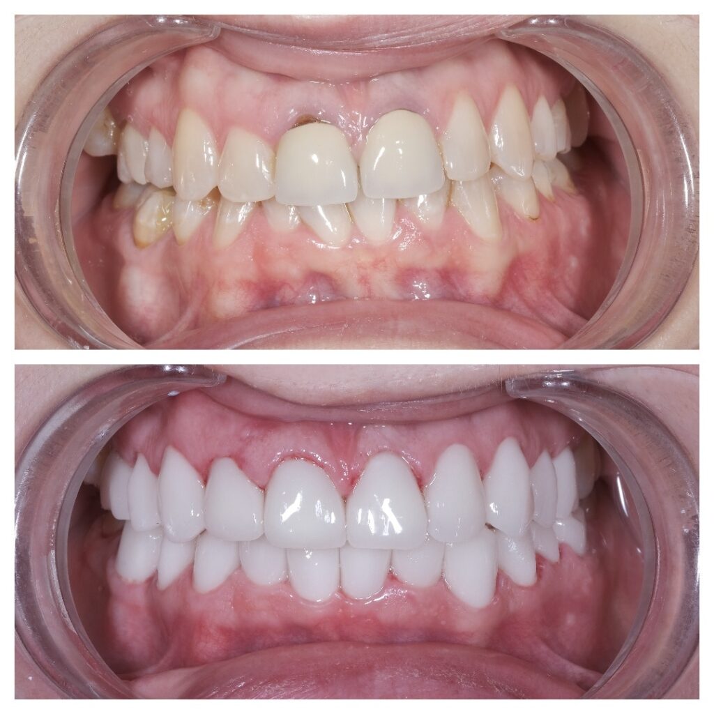 How Dentists Design a Smile That Fits Your Face How Dentists Design a Smile That Fits Your Face