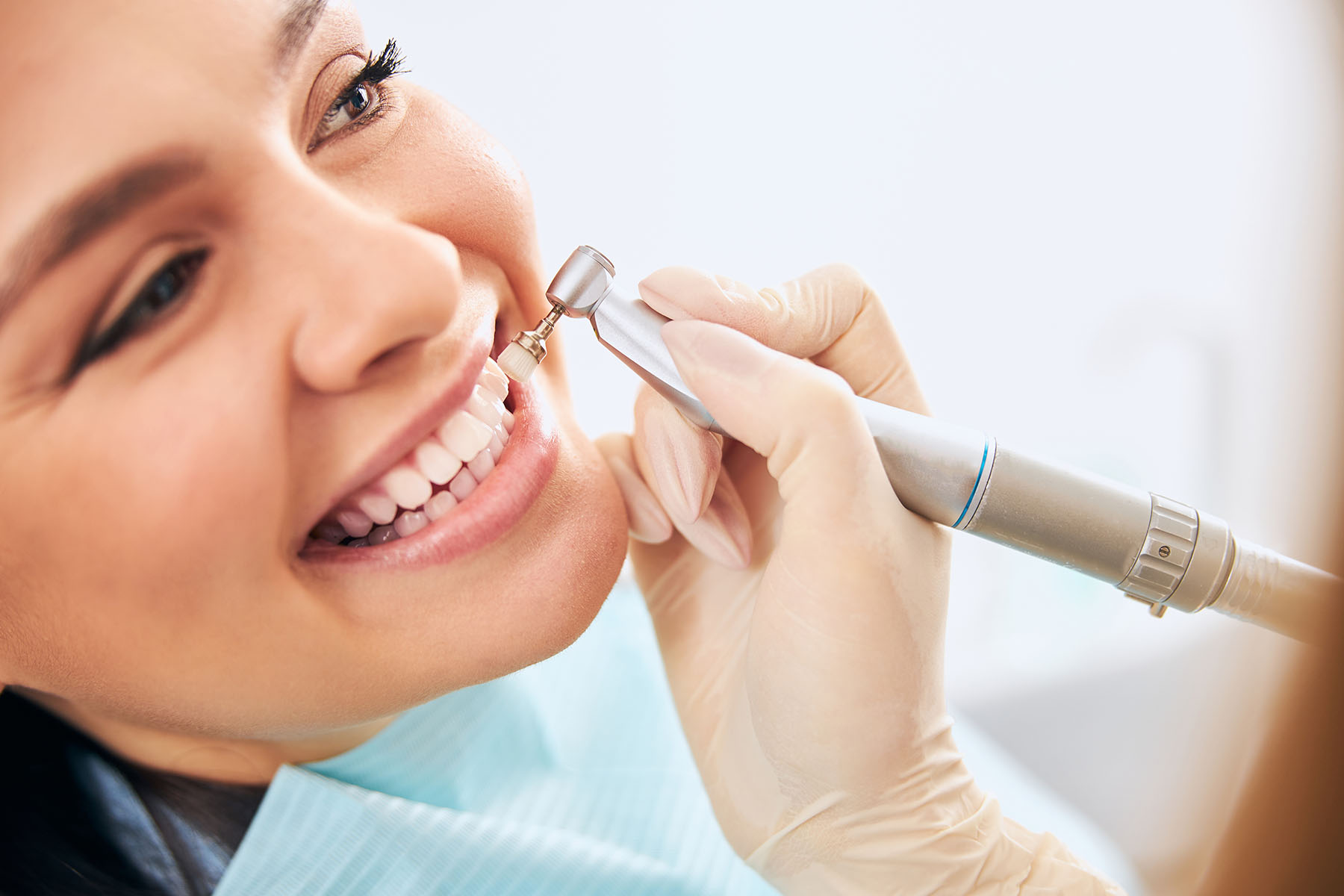 Teeth Cleaning in Turkey showing before and after results