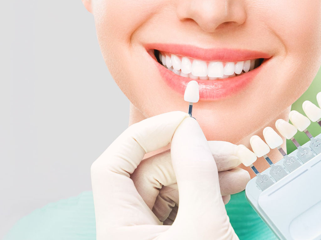 Zirconium Crowns in Turkey – Natural-looking, aesthetic dental crowns in Istanbul