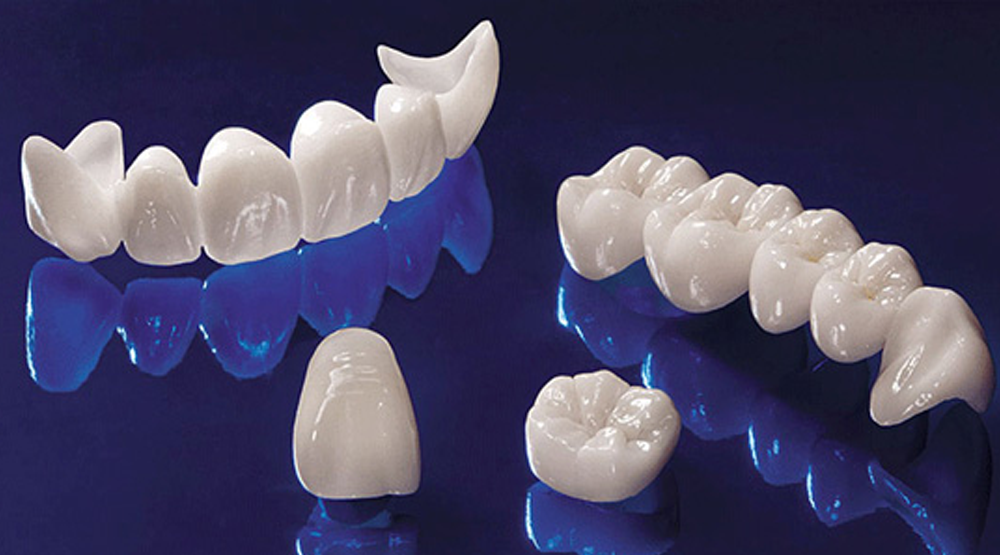 Zirconium Crowns in Turkey – Natural aesthetics and strong dental restoration