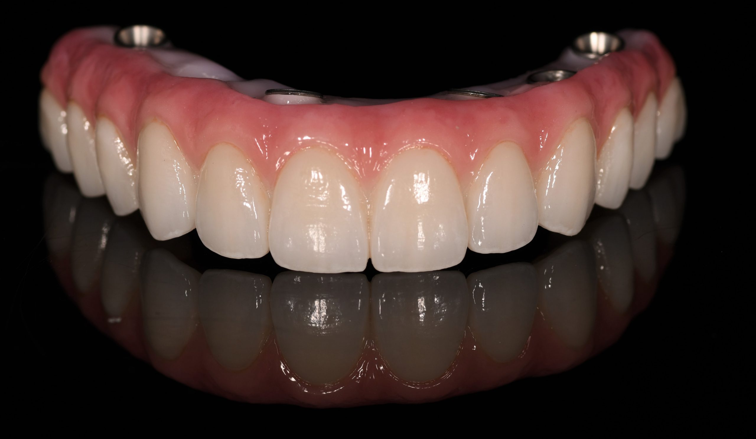 Full Teeth Prosthesis in Turkey – Istanbul skyline during dental tourism