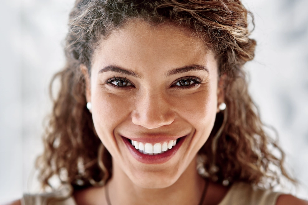 Hollywood Smile treatment process in Turkey showing before and after results