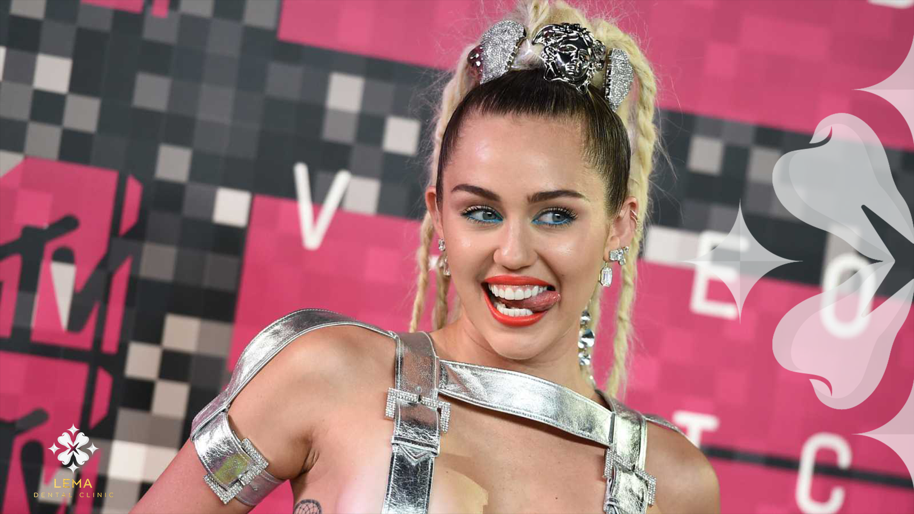 Miley Cyrus Hollywood Smile before and after – Turkey dental transformation example