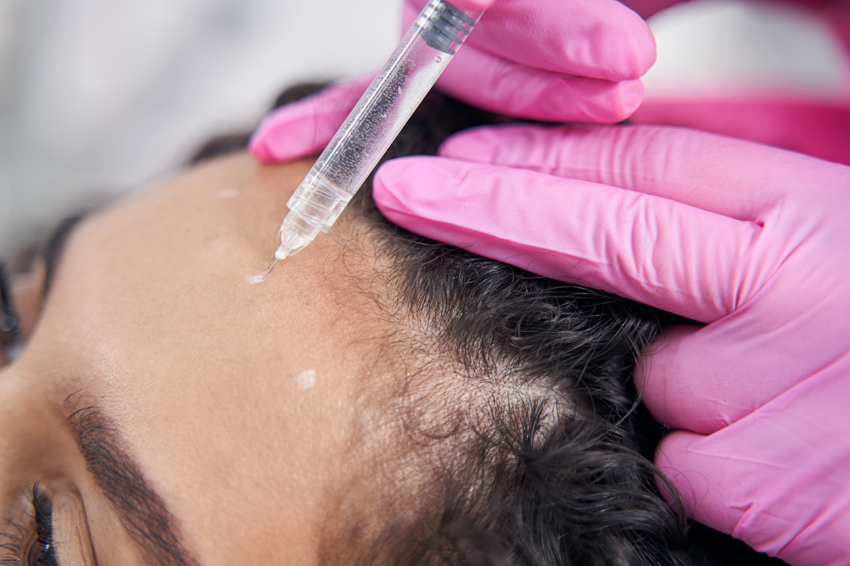 PRP Treatment in Turkey showing before and after skin rejuvenation results