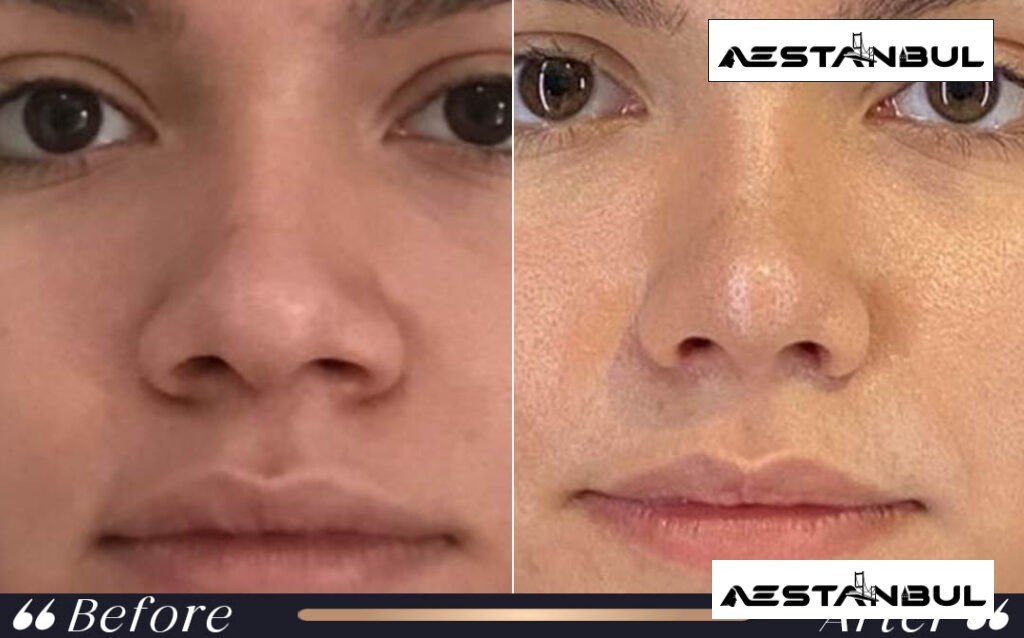 Facial Feminization Surgery UK Checklist - Facial Feminization Surgery Uk Checklist: UK Patient Checklist for 2026