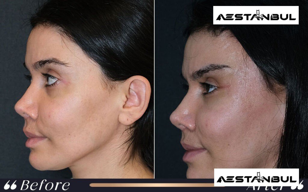 Facial Feminization Surgery UK Checklist - Facial Feminization Surgery Uk Checklist: UK Patient Checklist for 2026