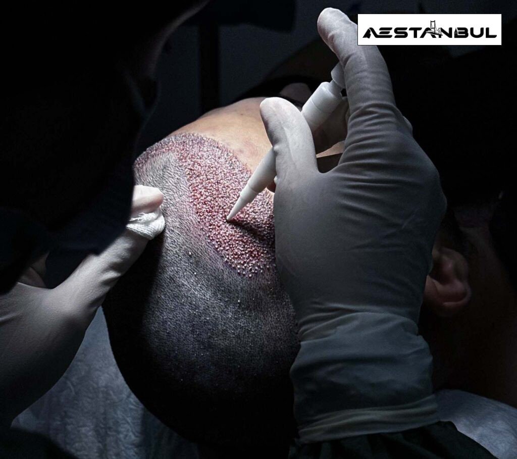 Beard Transplant Clinic Red Flags - Beard Transplant Clinic Red Flags: Clinic Red Flags and Safer Questions for 2026