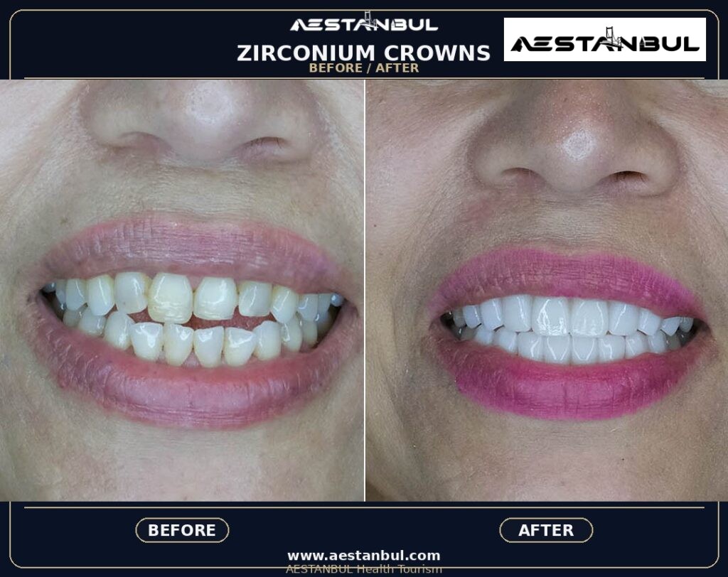 Dental Crowns Photo Consultation - Dental Crowns Photo Consultation: Photo Consultation Checklist for 2026