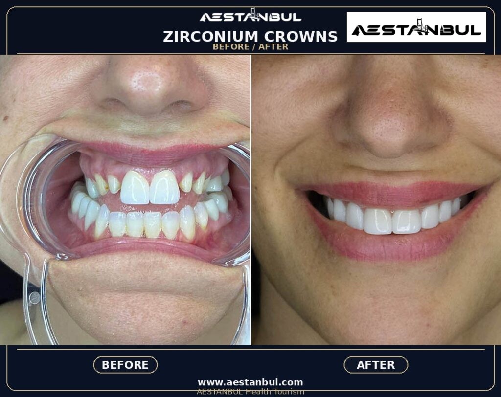 Dental Crowns Photo Consultation - Dental Crowns Photo Consultation: Photo Consultation Checklist for 2026