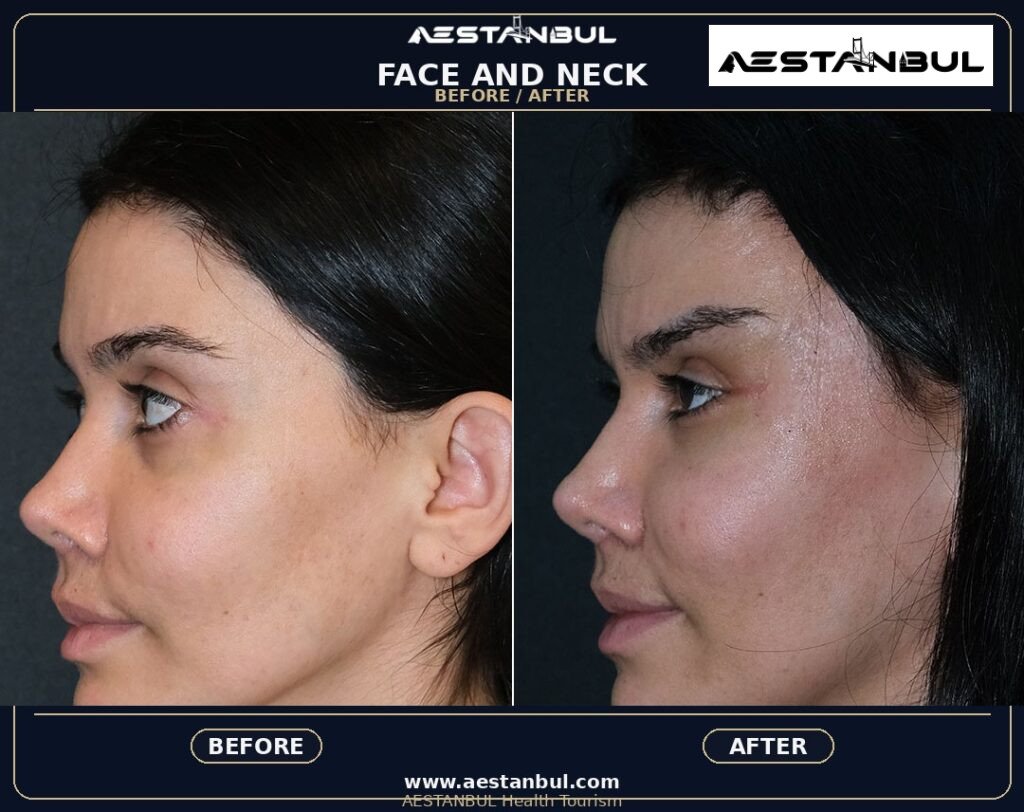 Facelift UK Checklist - Facelift Uk Checklist: UK Patient Checklist for 2026