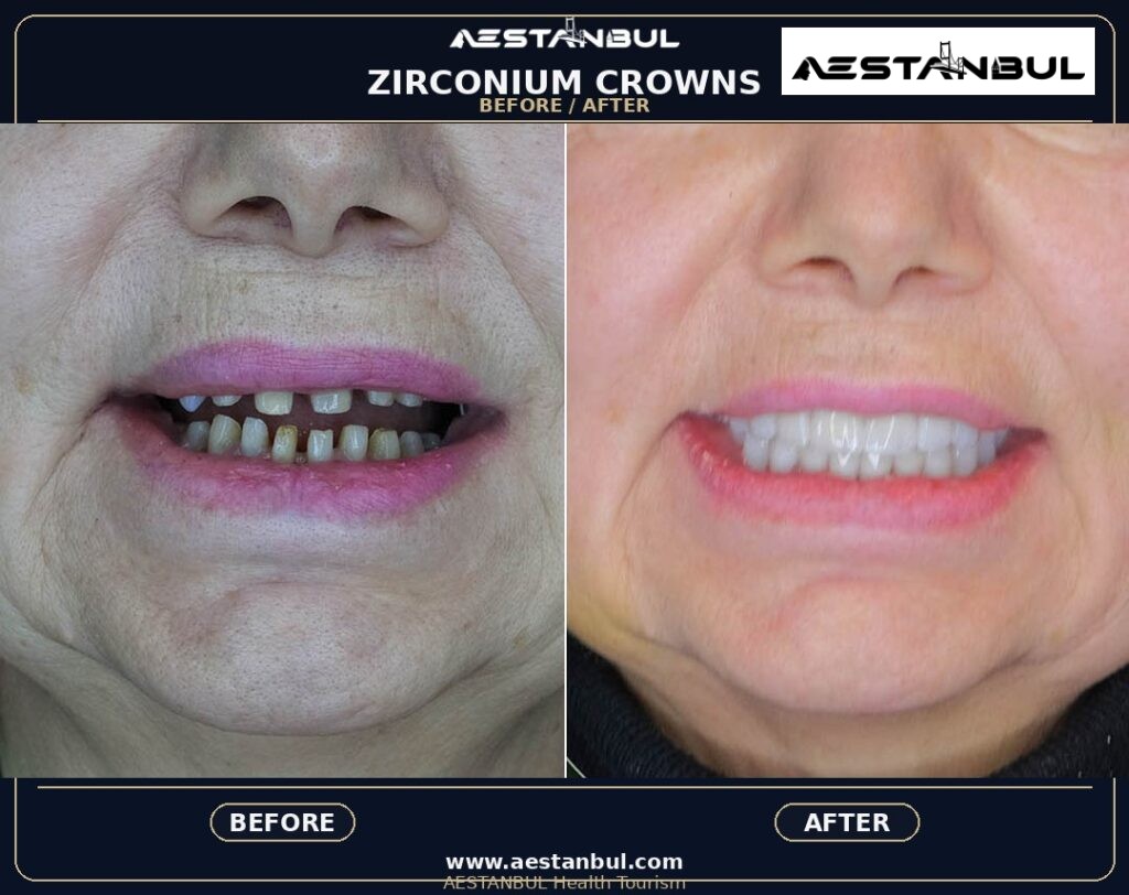 Dental Crowns Photo Consultation - Dental Crowns Photo Consultation: Photo Consultation Checklist for 2026