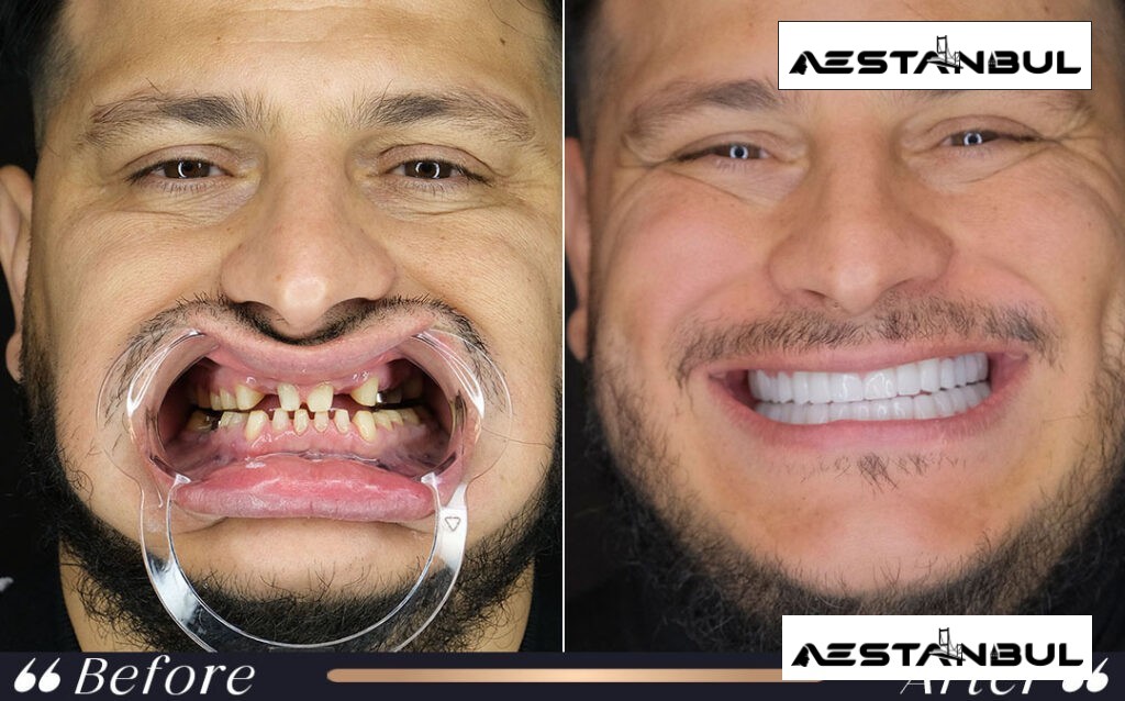 dental centre Turkey price list - Dental Centre Turkey Price List: Cost, Safety and Clinic Planning