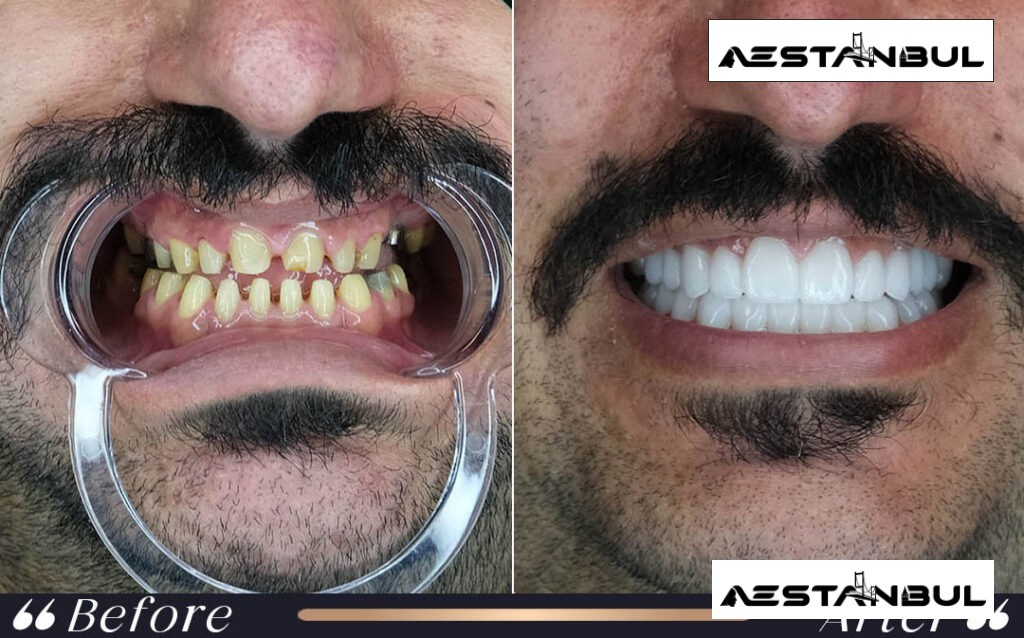 dental centre Turkey price list - Dental Centre Turkey Price List: Cost, Safety and Clinic Planning
