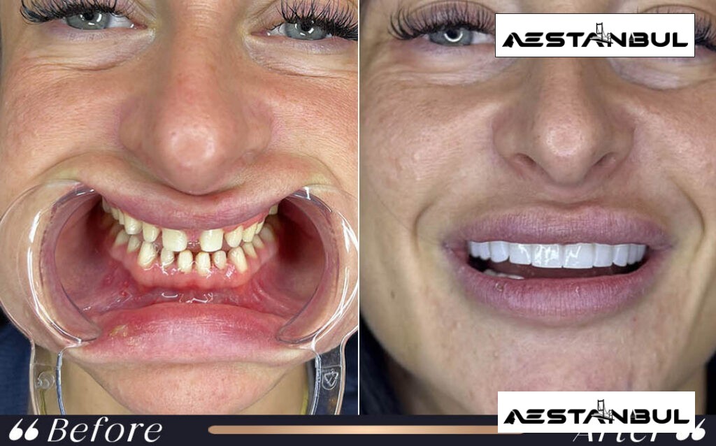 dental centre Turkey price list - Dental Centre Turkey Price List: Cost, Safety and Clinic Planning