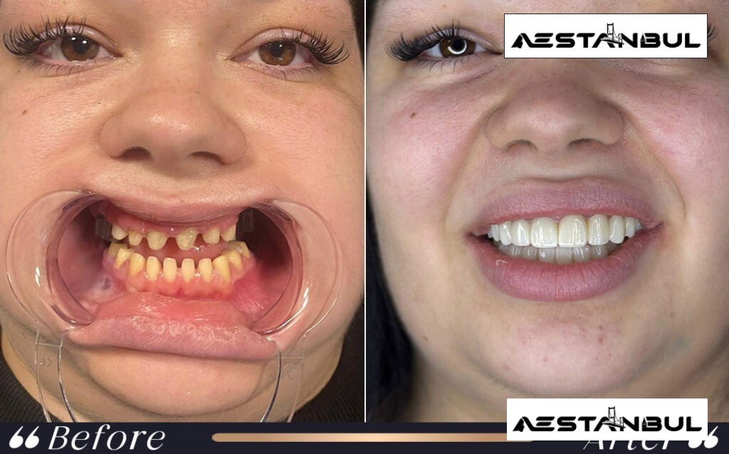 dental centre Turkey price list - Dental Centre Turkey Price List: Cost, Safety and Clinic Planning
